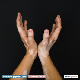 Bild 4 Med Pigment GmbH - Medizinische Pigmentierung Berlin & Narbenbehandlung Berlin in Berlin